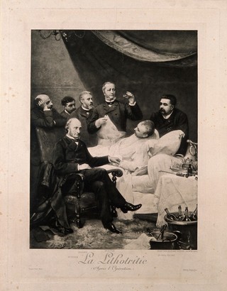 Jean-Casimir-Félix Guyon holding up a gall-stone in a bottle after performing a lithotrity on a male patient, other doctors monitor the patient's condition. Heliogravure by Dujardin after E. Bisson, 1890.