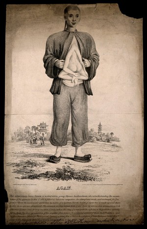 view Agan, a man with headless body attached at the chest. Lithograph by E. Stalker, 1833.