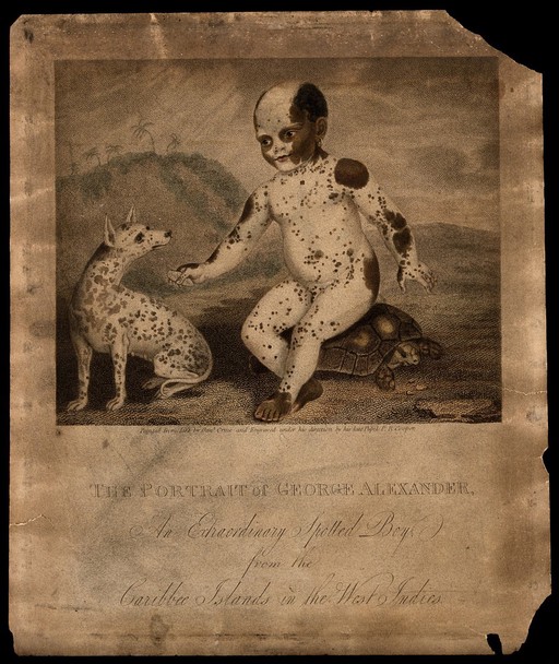 George Alexander, a black boy with white markings. Engraving by P.R. Cooper, 1809, after D. Orme.