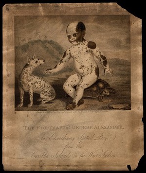 view George Alexander (Gratton), a black boy with white markings. Engraving by P.R. Cooper, 1809, after D. Orme.