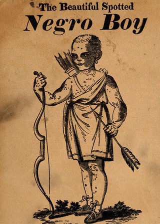 George Alexander (Gratton), a black boy with white markings. Reproduction of wood engraving.