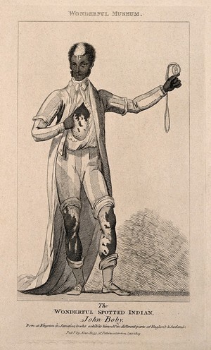 view John Boby, a black man with white markings. Reproduction of an etching, 1803.