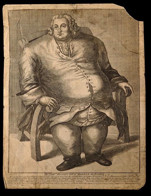 Edward Bright, a man weighing forty three and a half stone. Line engraving.