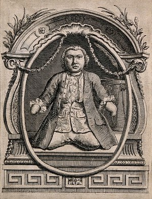 view Matthias Buchinger, a phocomelic man. Etching.