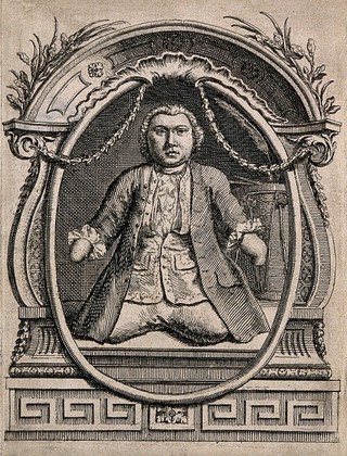 Matthias Buchinger, a phocomelic man. Etching.