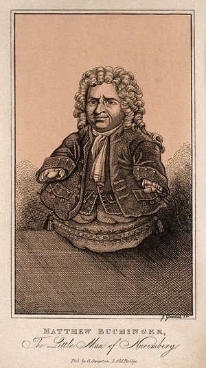 view Matthias Buchinger, a phocomelic man. Etching by J. Gleadah.