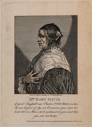 view Mary Davis, a woman with horns, aged 74. Engraving, 1792.