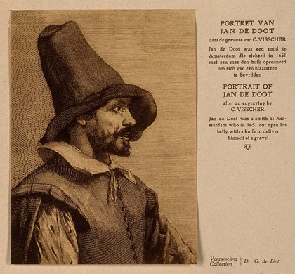 Jan de Doot, a man who extracted a bladder-stone from himself. Reproduction of an engraving, after C. Visscher.