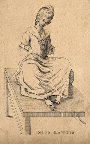 view Miss Hawtin, born without arms. Etching.