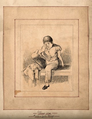 William Jones, a boy with deformed arms. Etching.