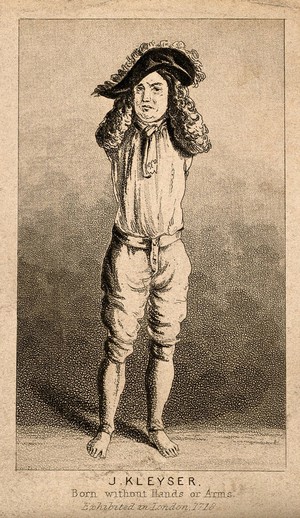 view Johann Kleyser, a man born without arms. Aquatint.