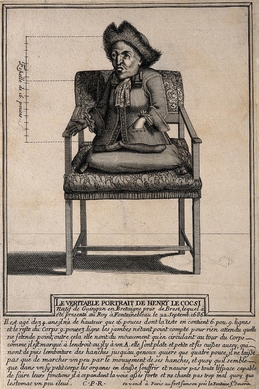 Henry Le Cocsi, a dwarf with paralysed legs, aged 34. Engraving.