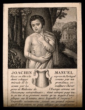 Joachin Manuel, a wounded man, and a breastplate that he had to wear as a result of his injuries. Stipple engraving.