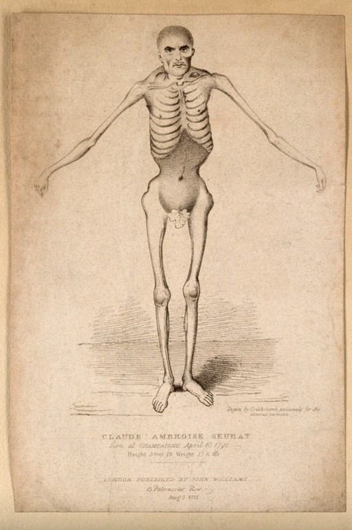 Claude Ambroise Seurat, a man weighing 77lbs and known as the 'Human Skeleton'. Stipple engraving by G. Cruikshank, 1825.