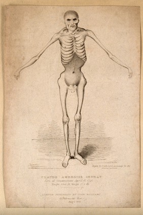 Claude Ambroise Seurat, known as the 'Human skeleton'. Stipple engraving by R. Cruikshank, 1825.