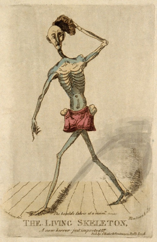 Claude Ambroise Seurat, a very thin man. Colour etching.