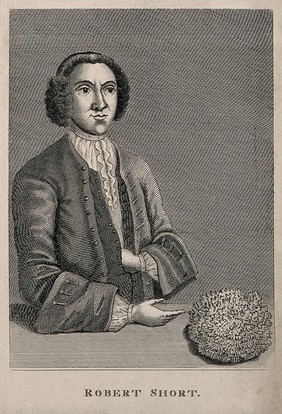 Robert Short, who had a bladder-stone removed which was eight inches in circumference. Engraving, 1820.