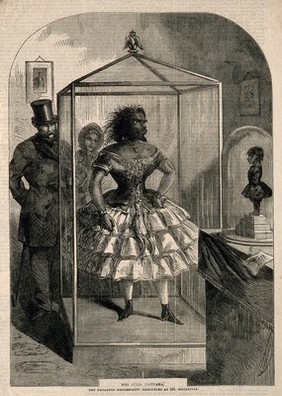 Julia Pastrana, a bearded woman, embalmed. Wood engraving, 1862.