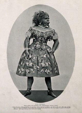 Julia Pastrana, a bearded woman. Process print after G. Wick.