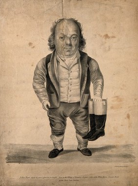 John Tarr, a dwarf, aged 67. Lithograph.