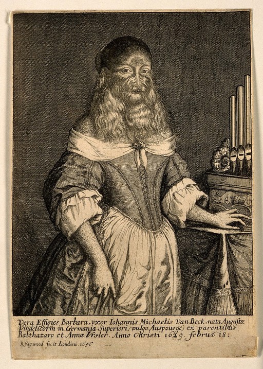 Barbara Vanbeck, a very hairy woman. Etching by R. Gaywood, 1656.