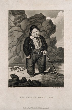 Hercules, a very large child. Aquatint by T. Cartwright, 1815, after E. Pugh.