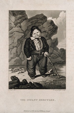 view Hercules, a very large child. Aquatint by T. Cartwright, 1815, after E. Pugh.