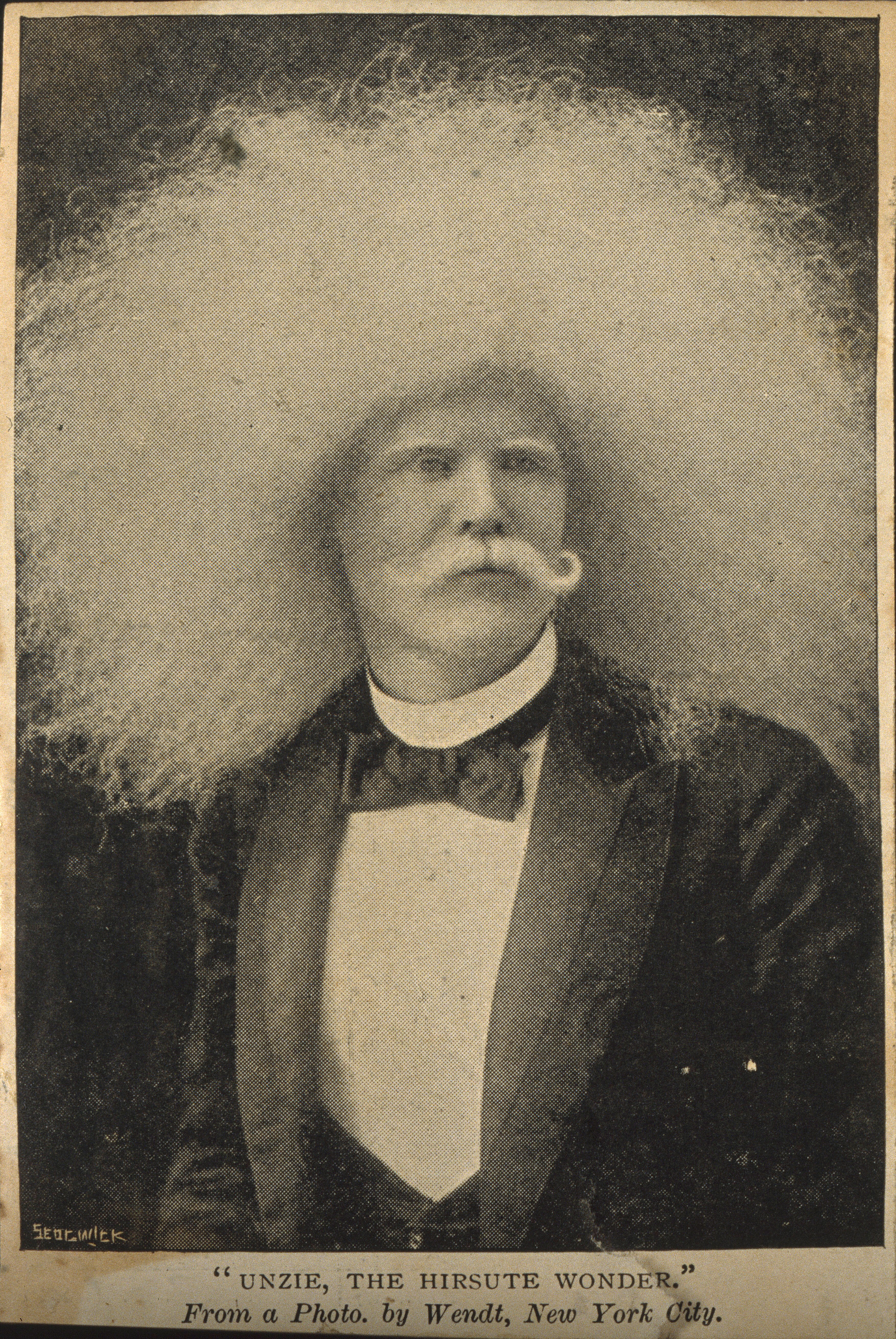Unzie An Albino Aboriginal Man With An Abundance Of White Hair