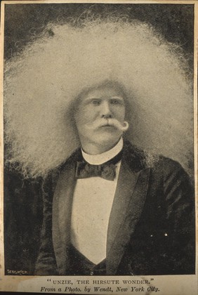 Unzie, an albino Aboriginal man with an abundance of white hair. Reproduction by Sedgwick after a photograph by Wendt, late nineteenth century.