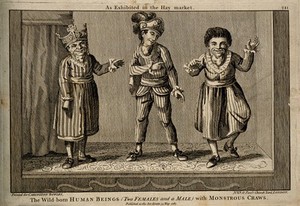 Three Wild Born People All With Goitre Engraving 1787 - 