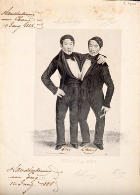 Chang and Eng the Siamese twins, one holding a book. Lithograph.