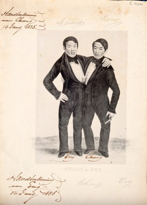 view Chang and Eng the Siamese twins, one holding a book. Lithograph.