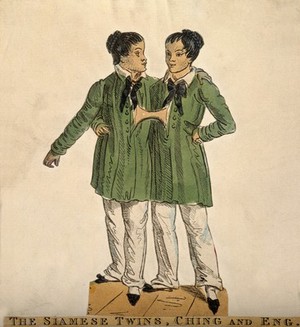 view Chang and Eng the Siamese twins. Coloured etching.