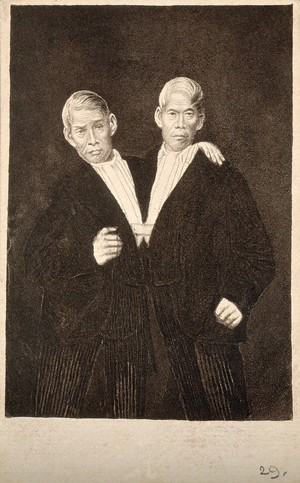 view Chang and Eng the Siamese twins, as old men. Aquatint.