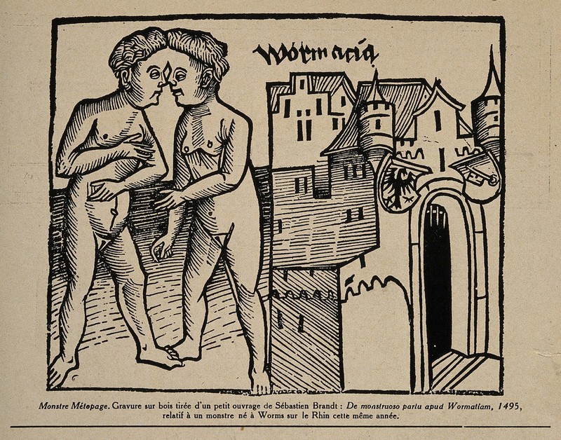 Conjoint twins, joined at the head, born at Worms in 1495. Reproduction of woodcut published in 1495., 1933, by Sebastian Brant