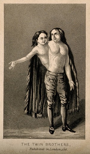 view A man with two heads and two trunks, 1716. Aquatint.