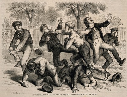 A boy with a supernumerary arm, fighting off six assailants. Wood engraving.