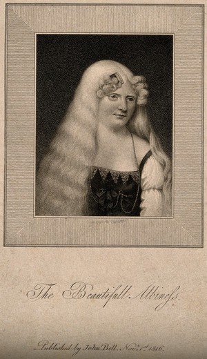 view A beautiful young albino woman. Stipple engraving, 1816.