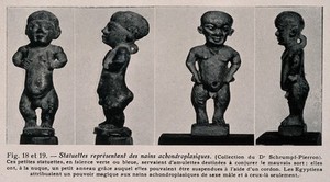 view Statuettes of two dwarfs. Reproduction, 1934, of a photograph.