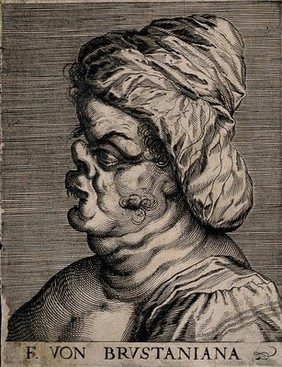 Frau von Brustaniana, a character with a grotesque face. Line engraving attributed to D. Custos.