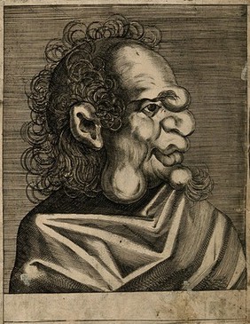 An unnamed character with a grotesque face. Line engraving attributed to D. Custos.