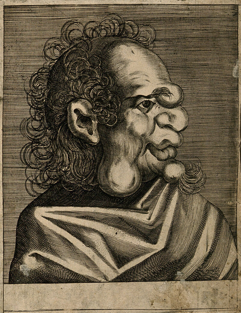 An unnamed character with a grotesque face. Line engraving attributed to D. Custos., by Dominicus Custos