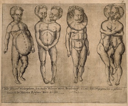 Four grotesquely deformed children. Line engraving.