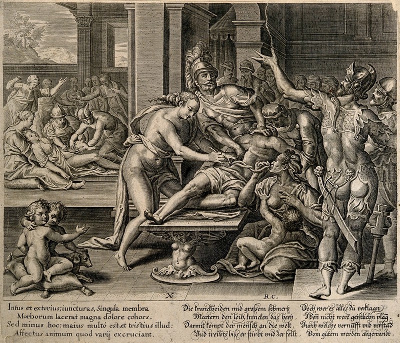 Two surgical operations (one a caesarian delivery) take place in a crowded courtyard. Engraving by R. Custos., by Raphael Custos