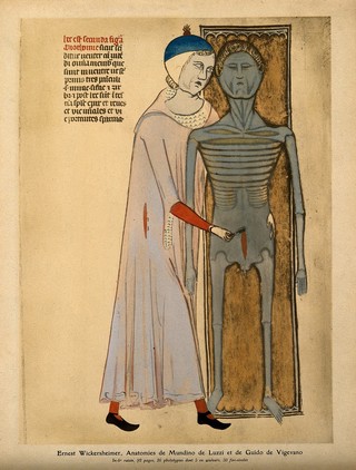 The dissection of an emaciated, grey cadaver by an anatomist who is making an abdominal incision with a scalpel with his right hand while his left hand is placed on the cadaver's hip. Colour process print, 1926, after a manuscript illustration, 1345.