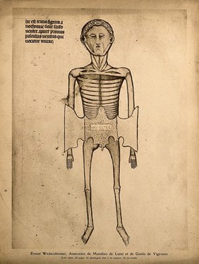A skeletal cadaver with two flaps of skin of the abdomen cut away to reveal the subcutaneous layer of muscle and fat, labelled "mirac". Process print, 1926, after a manuscript illustration, 1345.