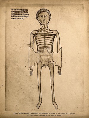 view A skeletal cadaver with two flaps of skin of the abdomen cut away to reveal the subcutaneous layer of muscle and fat, labelled "mirac". Process print, 1926, after a manuscript illustration, 1345.