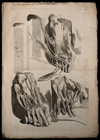 Three figures of the muscles of the foot, showing the sole of the foot progressively dissected.