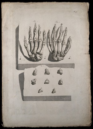 view The bones of the hand (fig.1: palmar; fig. 2: dorsal) and the wrist (fig. 3: detail of carpal bones). Engraving after G. de Lairesse, 1739.