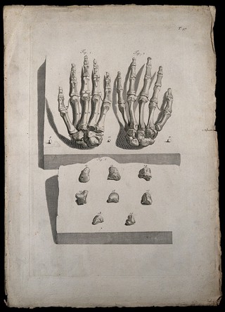The bones of the hand (fig.1: palmar; fig. 2: dorsal) and the wrist (fig. 3: detail of carpal bones). Engraving after G. de Lairesse, 1739.